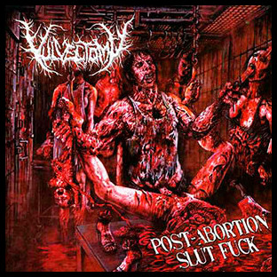 VULVECTOMY - Post-Abortion Slut Fuck