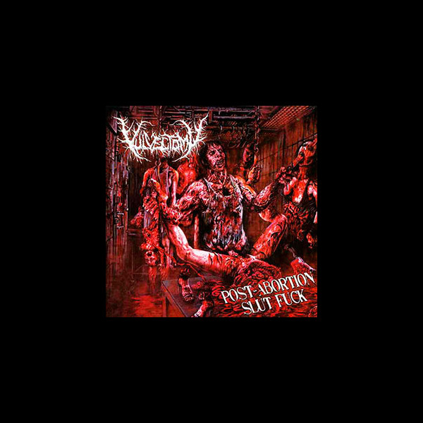 VULVECTOMY - Post-Abortion Slut Fuck