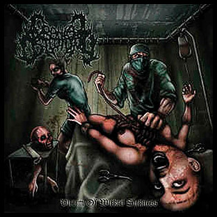 CRANIAL OSTEOTOMY - Victim of Wicked Sickness