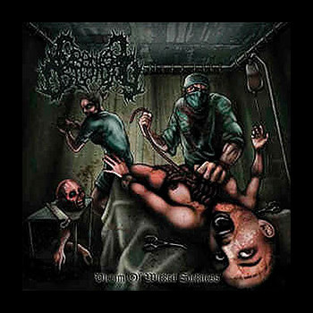 CRANIAL OSTEOTOMY - Victim of Wicked Sickness