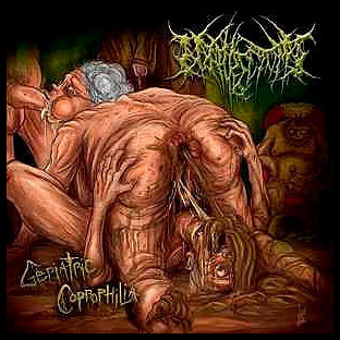 NEPHRECTOMY - Geriatric Coprophilia