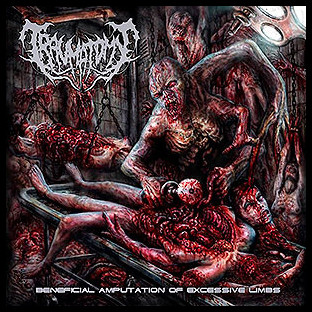 TRAUMATOMY - Beneficial Amputation of Excessive Limbs
