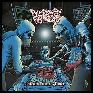 PULMONARY FIBROSIS - Idiopathic Pulmonary Fibrosis