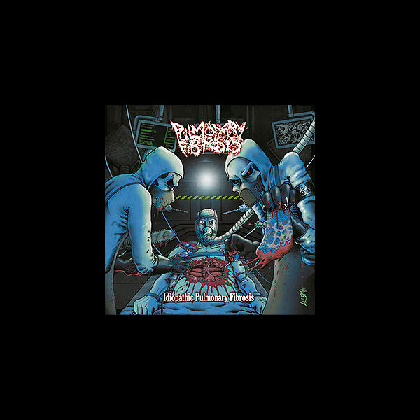 PULMONARY FIBROSIS - Idiopathic Pulmonary Fibrosis