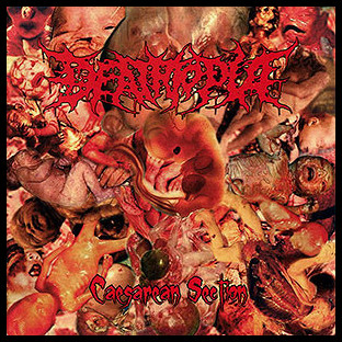 DEATHTOPIA - Caesarean Section