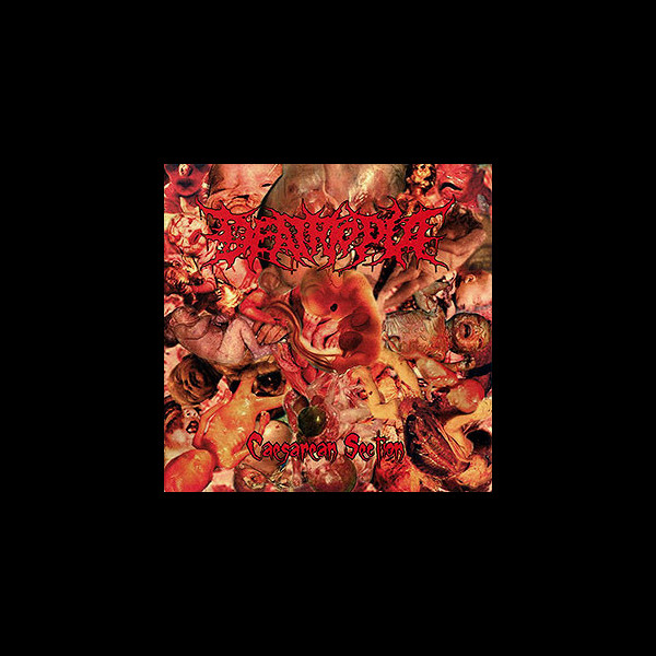 DEATHTOPIA - Caesarean Section