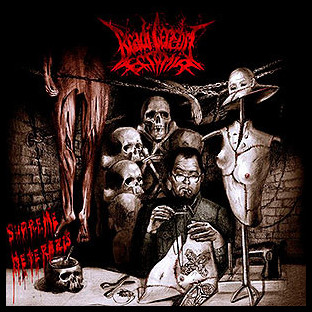 BRADI CEREBRI ECTOMIA - Supreme Heterozis