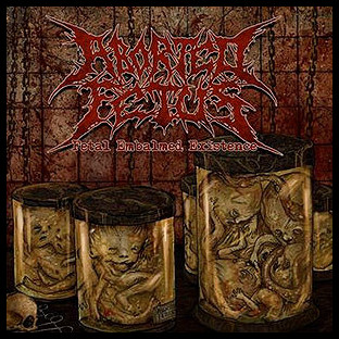 ABORTED FETUS - Fetal Embalmed Existence