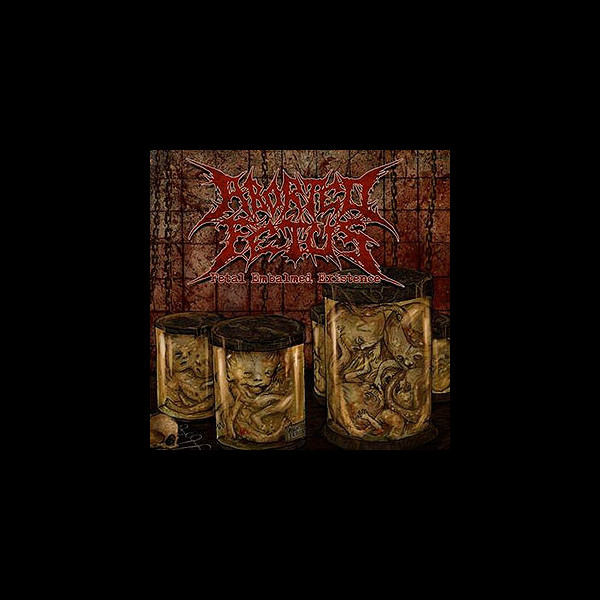 ABORTED FETUS - Fetal Embalmed Existence