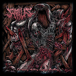 SYPHILIS - Coronary Artery Bypass Grafting