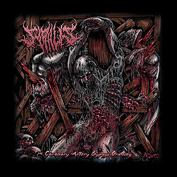 SYPHILIS - Coronary Artery Bypass Grafting