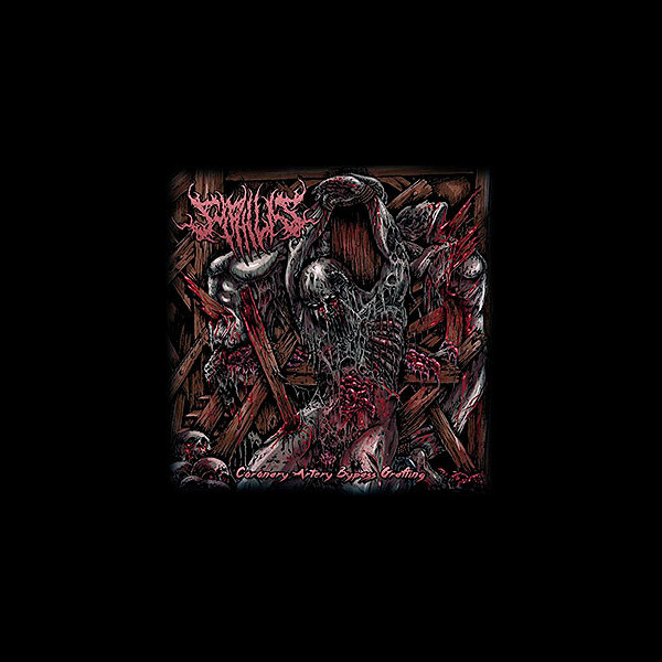 SYPHILIS - Coronary Artery Bypass Grafting