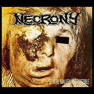 NECRONY - Severe Malignant Pustule