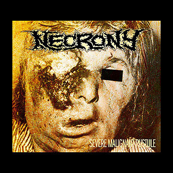 NECRONY - Severe Malignant Pustule