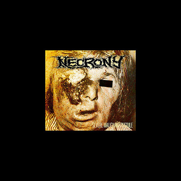NECRONY - Severe Malignant Pustule