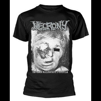 NECRONY - Severe Malignant Pustule
