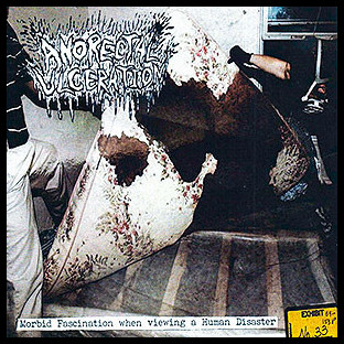 ANORECTAL ULCERATION - Morbid Fascination When Viewing a Human Disaster