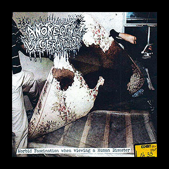 ANORECTAL ULCERATION - Morbid Fascination When Viewing a Human Disaster