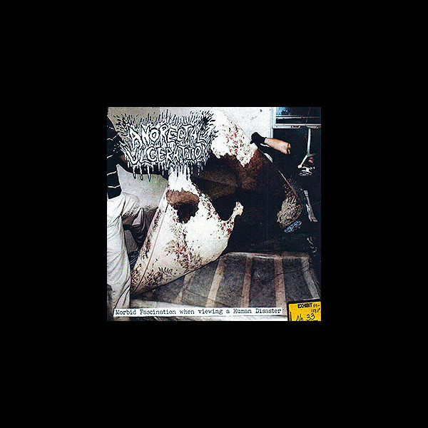 ANORECTAL ULCERATION - Morbid Fascination When Viewing a Human Disaster