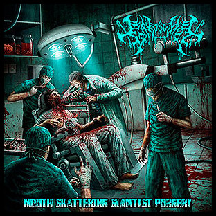 GINGIVECTOMY - Mouth Shattering Slamtist Purgery