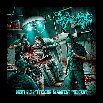GINGIVECTOMY - Mouth Shattering Slamtist Purgery