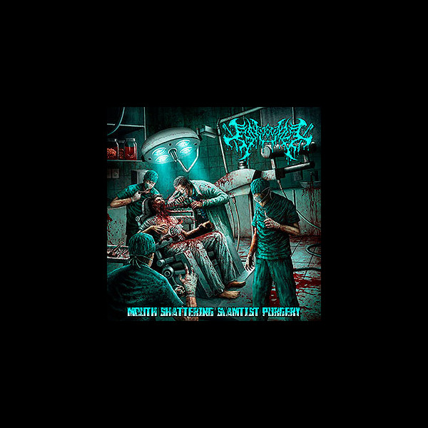GINGIVECTOMY - Mouth Shattering Slamtist Purgery