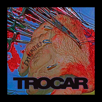 TROCAR - Extremities
