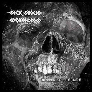 SICK SINUS SYNDROME - Rotten to the Core