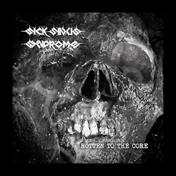 SICK SINUS SYNDROME - Rotten to the Core