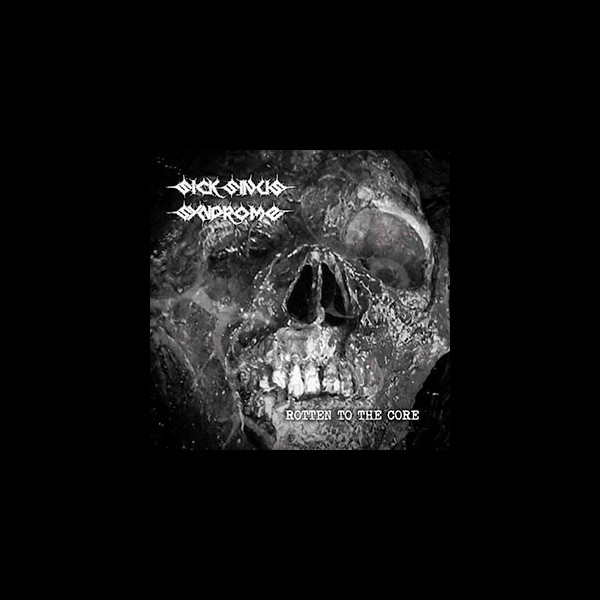 SICK SINUS SYNDROME - Rotten to the Core