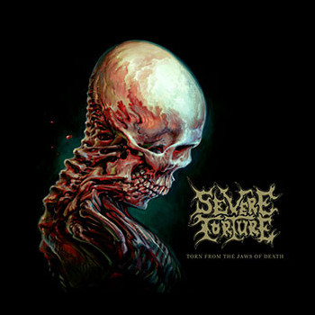 SEVERE TORTURE