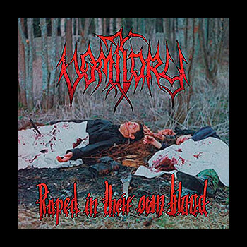 VOMITORY