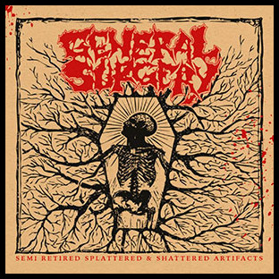 GENERAL SURGERY - Semi Retired Splattered & Shattered Artifacts