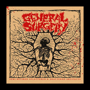GENERAL SURGERY