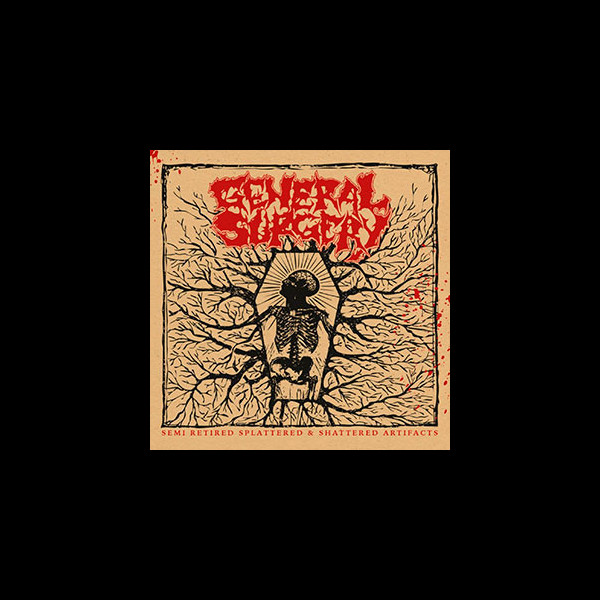 GENERAL SURGERY - Semi Retired Splattered & Shattered Artifacts