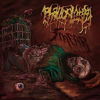 PHALLOPLASTY