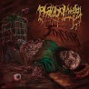 PHALLOPLASTY - Smear