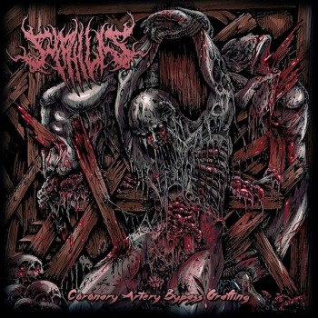 SYPHILIS