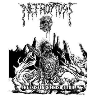 NEFROPTOSIS