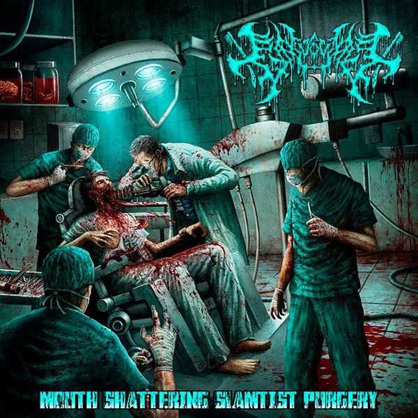 GINGIVECTOMY - Mouth Shattering Slamtist Purgery